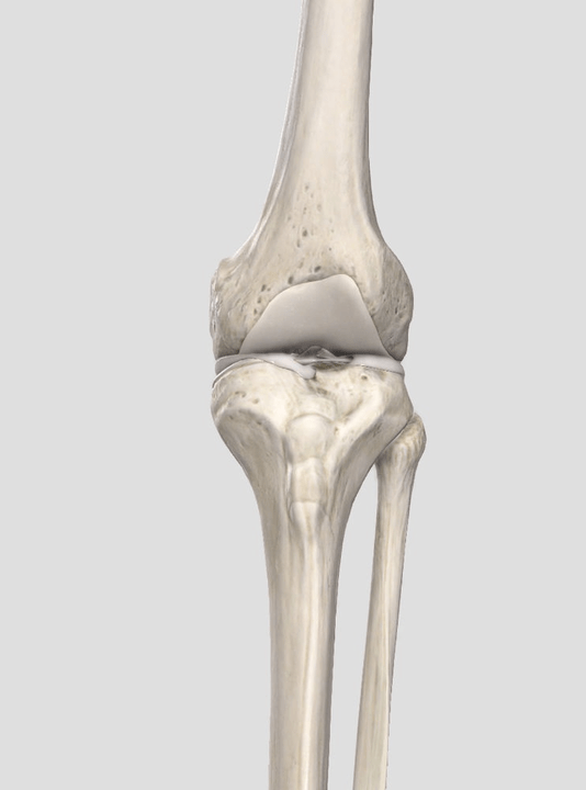 cartilage wear
