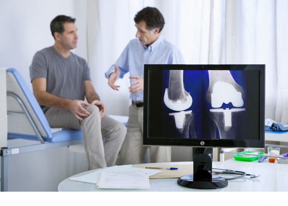 Knee joint osteoarthritis in image X -Ray